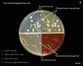 e.coli on various media